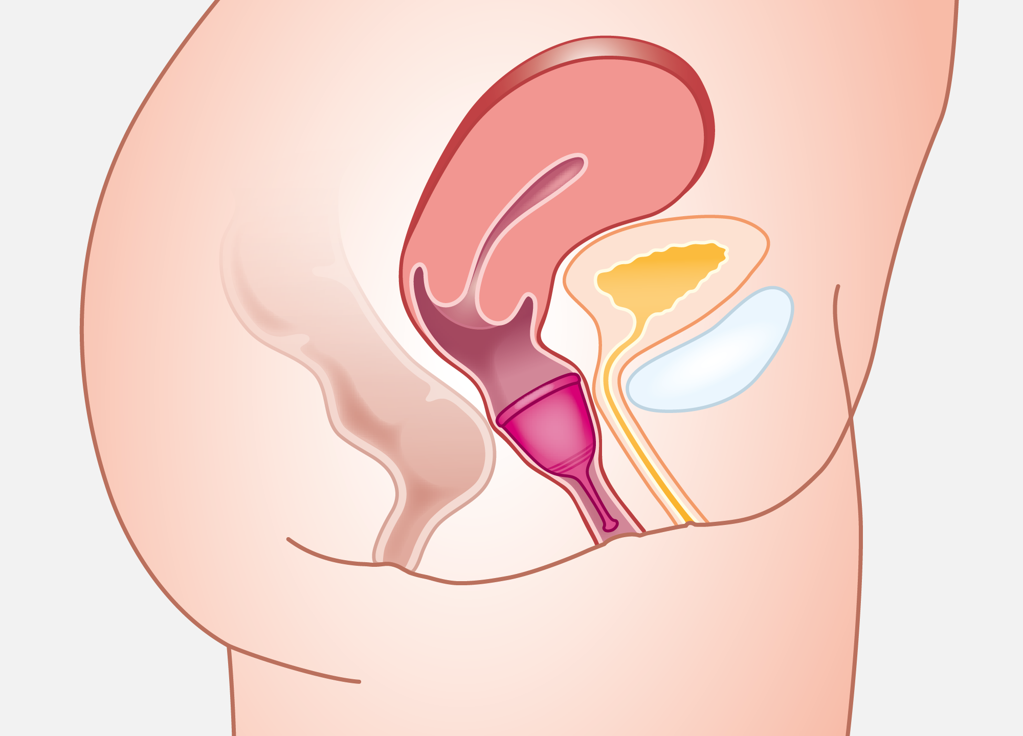 Platzierung der Menstruationstasse