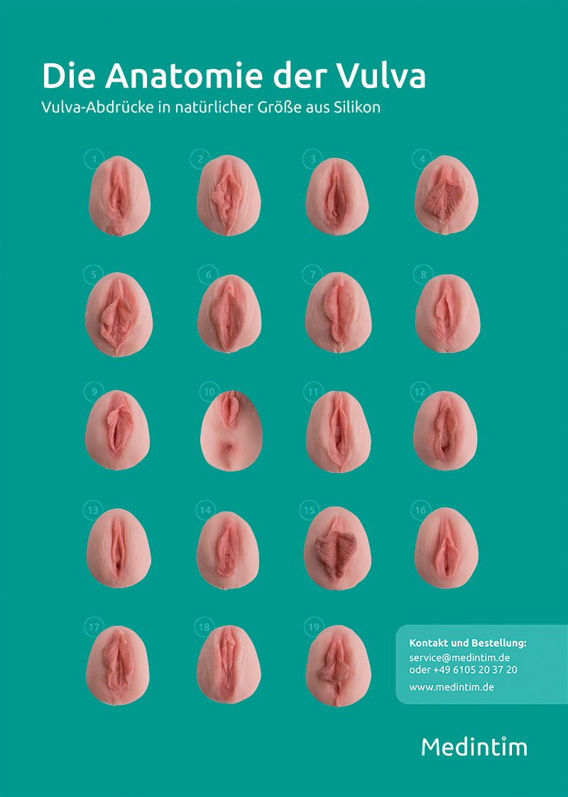 Vulva Plakat A4